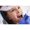 ORTHODONTICS: THE SOLUTION FOR ALIGNING TEETH